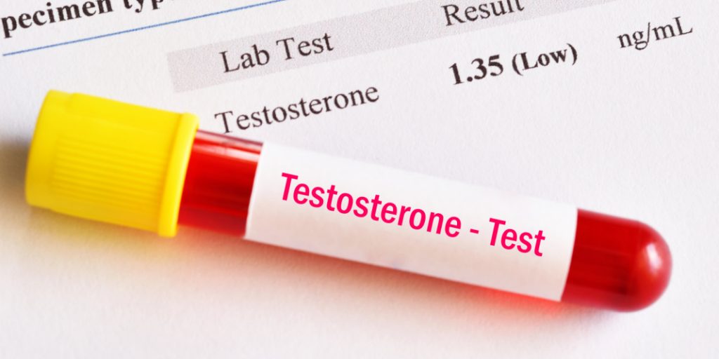 Testosteron Wie es wirkt und wie du es steigern kannst REP ONE Testosteron Wie es wirkt und wie du es steigern kannst REP ONE