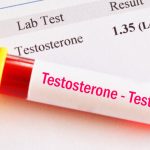 Testosterone Test